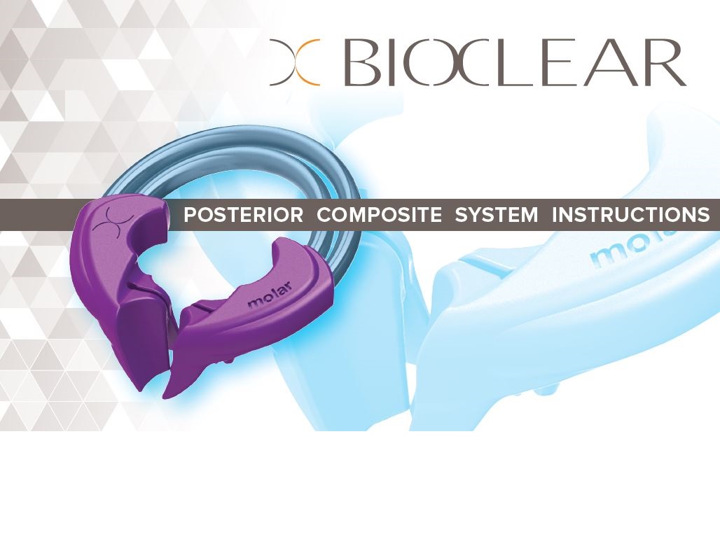 POSTERIOR COMPOSITE SYSTEM INSTRUCTIONS